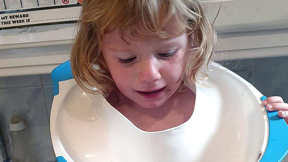 2χρονη σφήνωσε με το κεφάλι σε... παιδικό κάθισμα τουαλέτας!