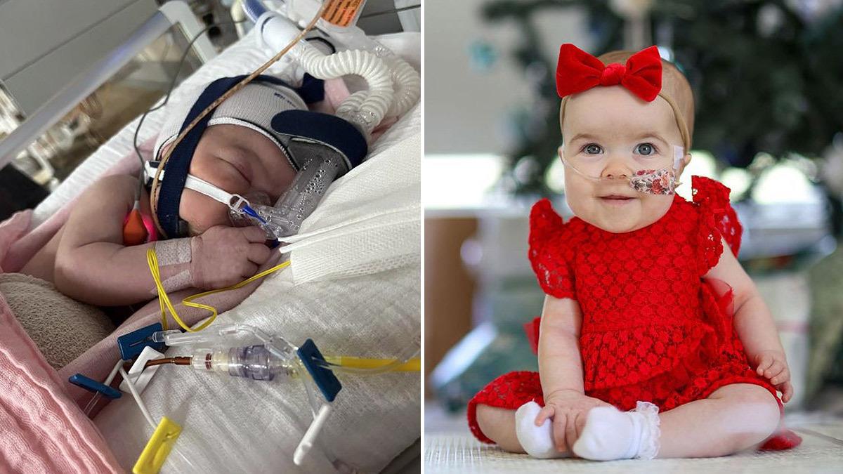 Μπεμπούλα που γεννήθηκε με ζωτικά όργανα έξω από το σώμα της, επιβίωσε και είναι καλά!