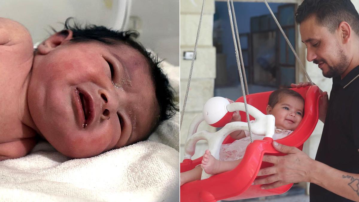 Το μωράκι που γεννήθηκε στα συντρίμμια της Συρίας έγινε 6 μηνών και δυναμώνει κάθε μέρα