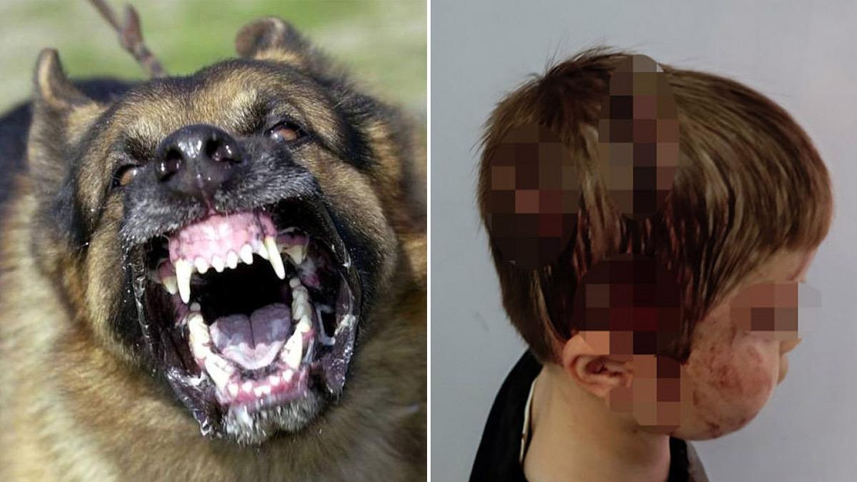 Γιαννιτσά: σκύλος επιτέθηκε και δάγκωσε 6χρονο παιδί στο κεφάλι