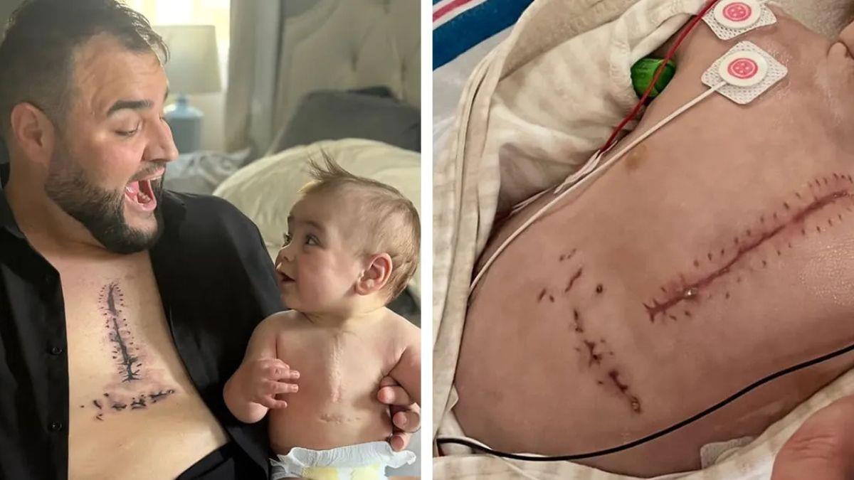 Μπαμπάς έκανε τατουάζ ίδιο με την ουλή του γιου του