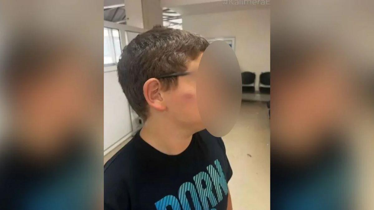 11χρονος ξυλοκοπήθηκε από συμμαθητές του στο σχολείο - του κάνουν 3 χρόνια bullying