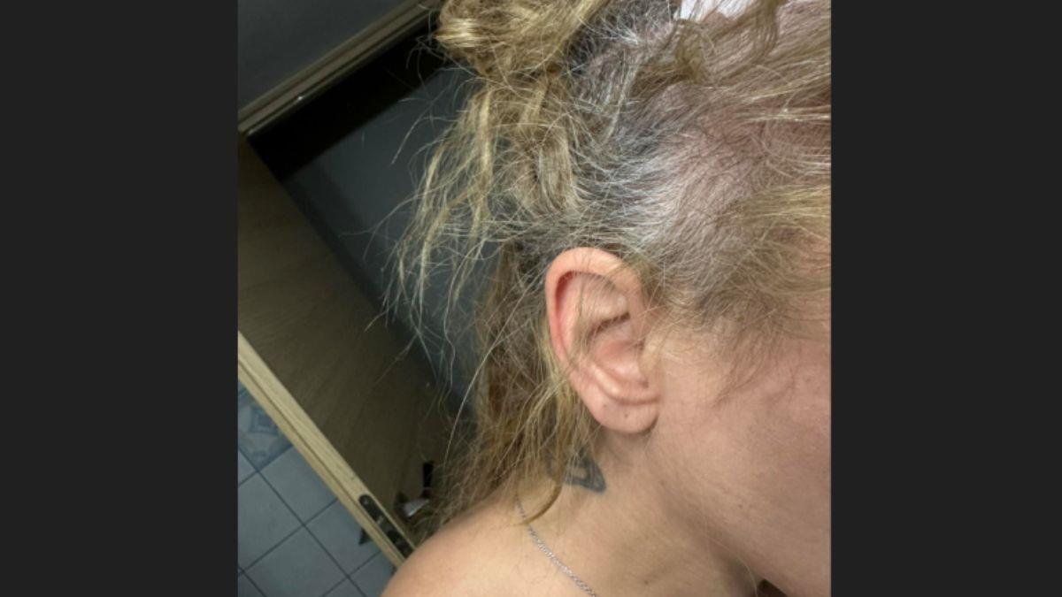 Νταής επιτέθηκε σε γυναίκα οδηγό  επειδή «πήγαινε αργά» - της ξερίζωσε τα μαλλιά!