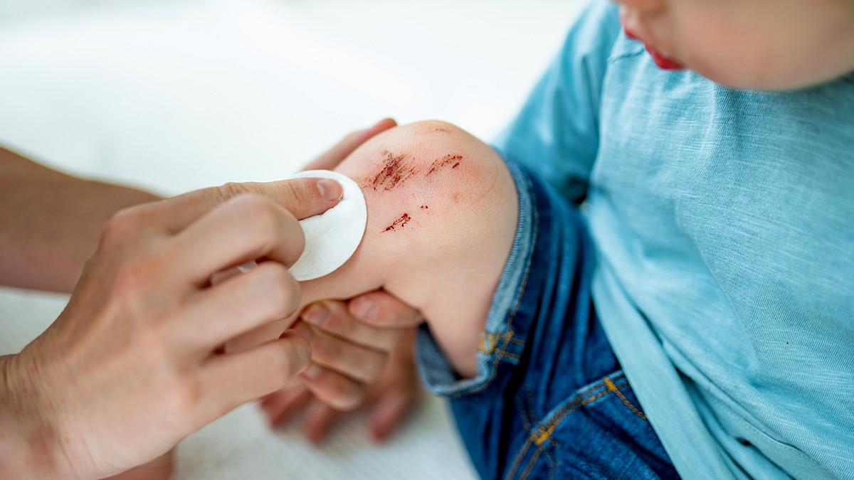 Οι πρώτες βοήθειες που πρέπει να ξέρει κάθε γονιός