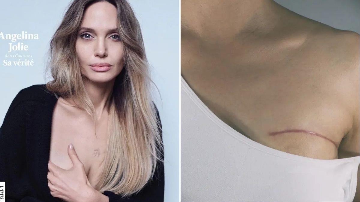 Α.Τζολί για μαστεκτομή: «δεν με ελκύει η ιδέα μιας τέλειας ζωής χωρίς πληγές»