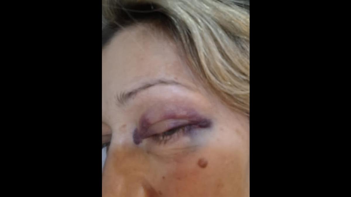 «Θα το ξαναέκανα και με μωβ μάτι»: καθηγήτρια έγινε «ασπίδα» για μαθητές της που δέχτηκαν επίθεση