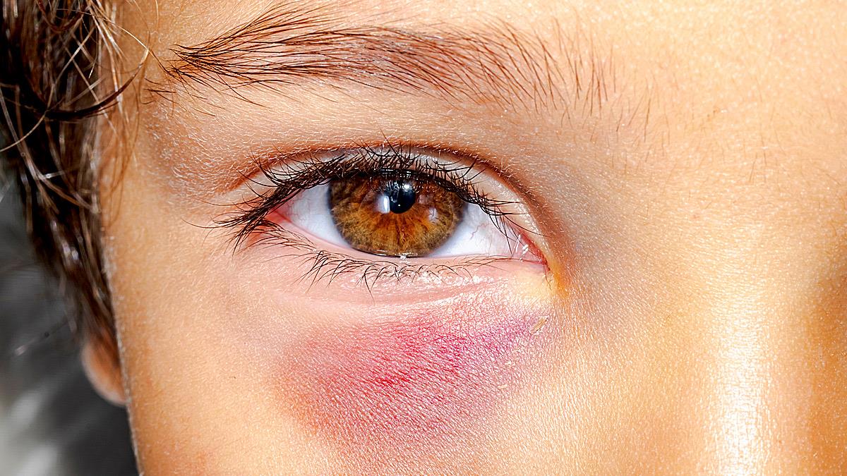 16χρονος ξυλοκόπησε άγρια μαθητή της Γ’ Δημοτικού - είχε πάνω του μαχαίρι