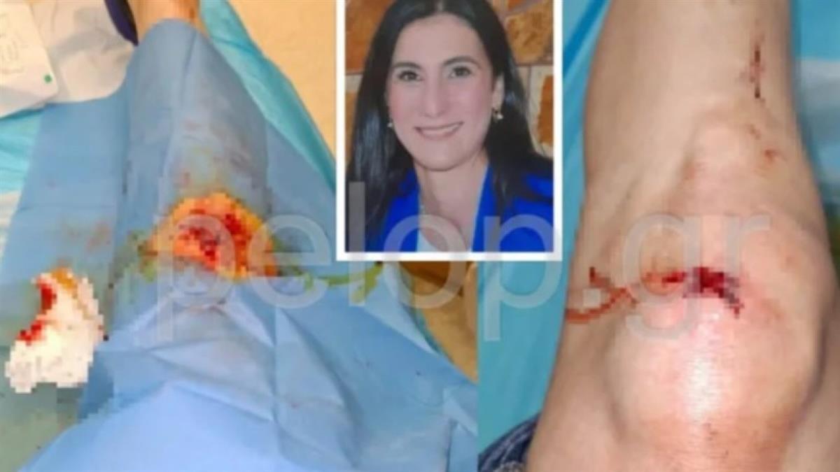 Πάτρα: άγρια επίθεση σε μαμά 3 παιδιών - τη λήστεψαν και την πέταξαν σε χαντάκι