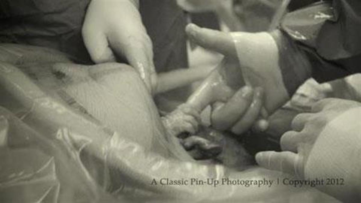 Νεογέννητο πιάνει το δάχτυλο του γιατρού (Φωτο)