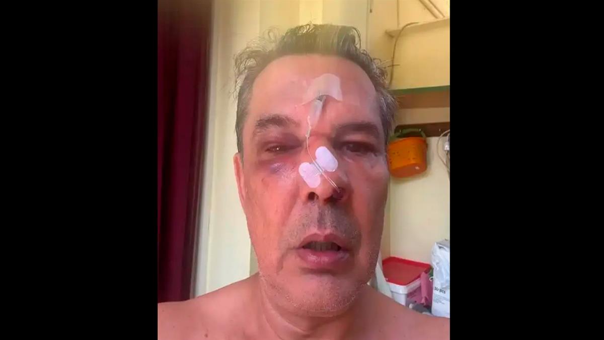 Χαϊδάρι: ξυλοκόπησε άνδρα σε ιατρείο επειδή του είπε να μιλά πιο σιγά στο κινητό