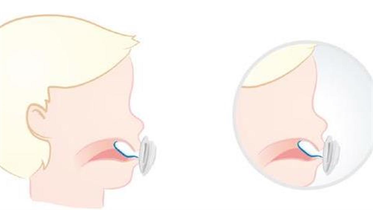 Η πιπίλα και η ανάπτυξη του στόματος