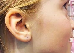 «Γιατί δεν πίεσα την κόρη μου να τρυπήσει τα αυτιά της»: Το μάθημα ζωής ενός μπαμπά στην κόρη του