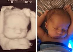 Νεογέννητο μωράκι κοιμάται με τον ίδιο τρόπο που... χαλάρωνε στη μήτρα