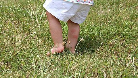 Τα τσιμπήματα του καλοκαιριού: Πώς να αντιμετωπίστε την κάθε περίπτωση 