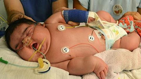 Γεννήθηκε φυσιολογικά με βάρος 6,1 κιλά