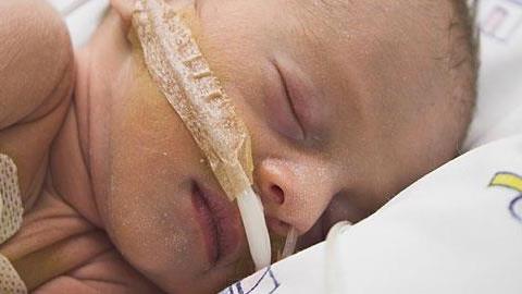 Οι μακροχρόνιες επιπτώσεις του να γεννηθεί ένα μωρό πρόωρο