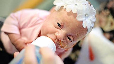 Μωράκια στην εντατική: Συγκινητικά φωτογραφικά στιγμιότυπα των μικρών ηρώων!