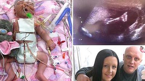 Τους είπαν ότι το μωρό τους θα πέθαινε, όμως πίστεψαν στο θαύμα!