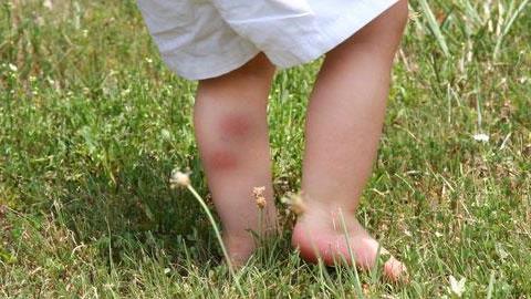 Πώς αντιμετωπίζονται οι παιδικές δερματικές παθήσεις της άνοιξης