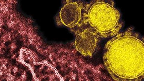 Όλα όσα πρέπει να γνωρίζετε για τον κοροναϊό MERS