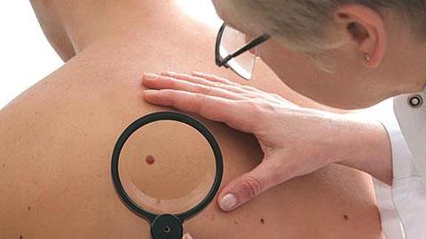 Δωρεάν δερματολογικός έλεγχος από τις 4 έως τις 8 Μαΐου