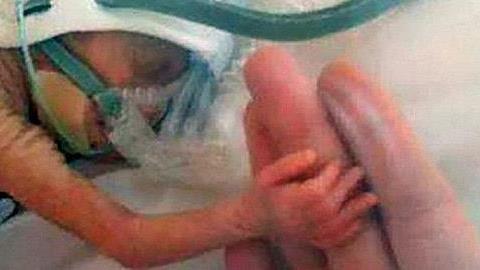 Η δύναμη της ζωής: Δείτε το μωρό που γεννήθηκε μισό κιλό... 10 εβδομάδες μετά! (φωτο)