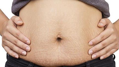 Αντιμετώπιση ραγάδων: Πού οφείλονται και πώς θα απαλλαγείτε οριστικά