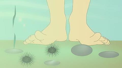 Πρώτες βοήθειες για τα μικροατυχήματα των διακοπών