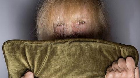 Σχιζοφρένεια: Τα ανησυχητικά συμπτώματα και πώς αντιμετωπίζονται