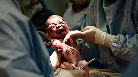 Φωτογραφίες τοκετού που κόβουν την ανάσα