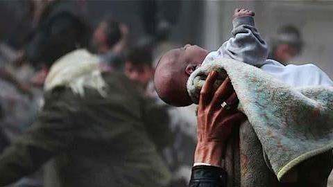 Δεν φαντάζεστε από τι επιβιώσε αυτό το νεογέννητο (προσοχή: σκληρές εικόνες)