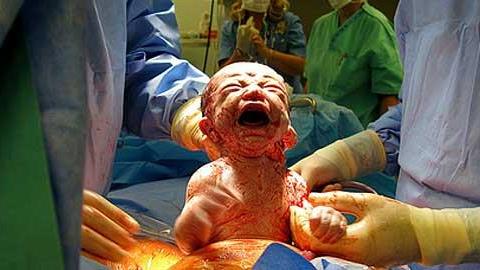 Το θαύμα της ζωής: Το συγκλονιστικότερο βίντεο που έχετε δει μέχρι σήμερα!