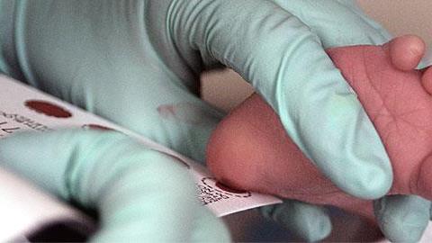 Συγγενής υποθυρεοειδισμός: Πώς να προφυλάξετε το μωρό σας!