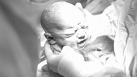 Η ομορφιά της καισαρικής σε 13 συγκλονιστικές φωτογραφίες