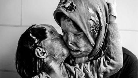 16 φωτογραφίες που θυμίζουν ότι πάνω απ’όλα είμαστε άνθρωποι!