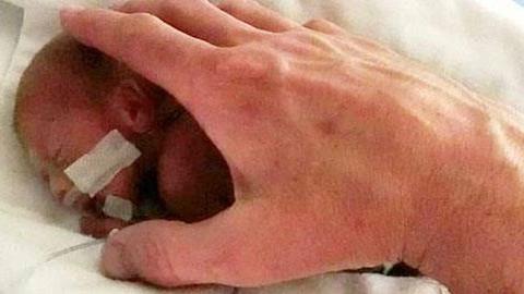 Το πρόωρο μωράκι που επέζησε από θαύμα: Μία απίστευτη ιστορία!