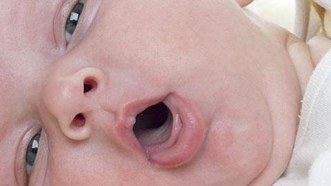 Πώς να αντιμετωπίσω το βήχα του 4,5 μηνών μωρού μου;