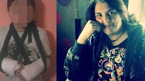 Σοκ στη Λέσβο: Κρέμασαν μαθητή σε μπασκέτα και έσπασε τα χέρια του (video)