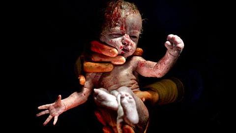 Από τη μήτρα στον κόσμο: Φωτογραφίες νεογέννητων την στιγμή που έρχονται στον κόσμο!