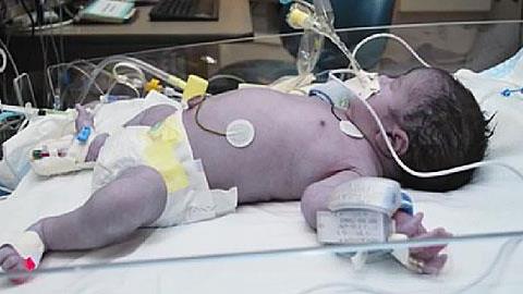 Συγγενής καρδιοπάθεια σε βρέφη: Η εξέταση που σώζει ζωές