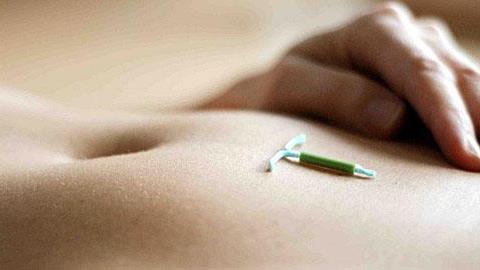 Δικαιολογείται η αιμορραγία μετά την τοποθέτηση σπιράλ;