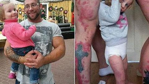 Έκαναν τατουάζ με τα σημάδια της κόρης τους για να μη νιώθει μόνη