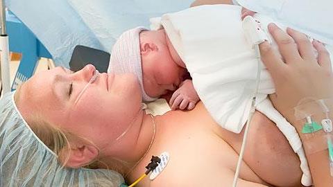 Μια νέα μέθοδος καισαρικής που θυμίζει φυσιολογικό τοκετό