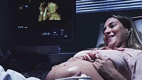 Απίστευτο: Δείτε τι έκανε ένας γιατρός για αυτή την τυφλή έγκυο