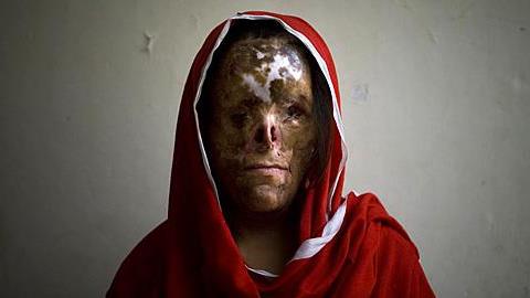 Δείτε τι έκαναν σε αυτές τις γυναίκες που αρνήθηκαν να παντρευτούν