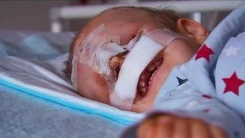 Δείτε τη μεταμόρφωση του αγοριού που γεννήθηκε χωρίς μάτια και μύτη