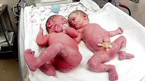 Η συγκλονιστική στιγμή που δίδυμα νεογέννητα συναντιούνται για πρώτη φορά (video)!