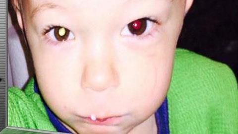 Δείτε πώς μια απλή φωτογραφία βοηθά να διαγνωστεί ο παιδικός καρκίνος