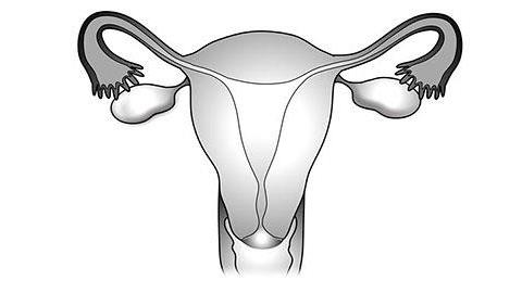 Έχω βουλωμένη σάλπιγγα και προσπαθώ να μείνω έγκυος. Θα βοηθούσε η σπερματέγχυση;