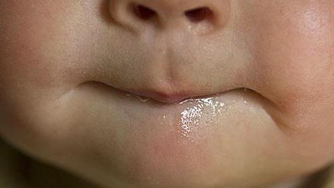 Η μύτη του 1 μηνός γιου μου είναι βουλωμένη από τη μέρα που γεννήθηκε. Τι να κάνω;